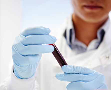 Scientist holding blood sample