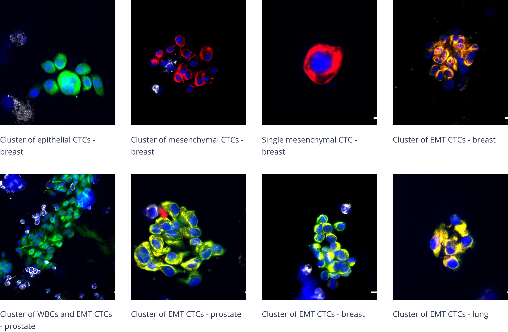 Portrait+ CTC Staining Kit | ANGLE plc